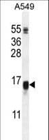 WFDC12 Antibody (aa66-94)