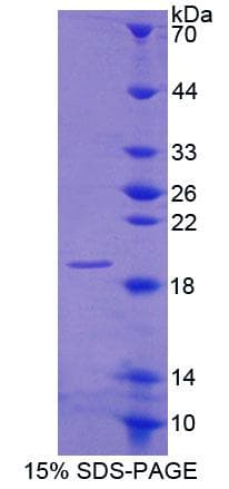Human CNRIP1 Protein (Recombinant His-T7, N-terminus)