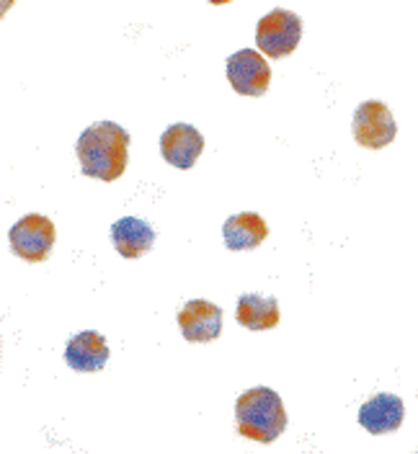 ERN1 / IRE1 Antibody