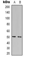 Polyclonal Rabbit anti-Human FOXN4 Antibody (C-Terminus, IHC, WB)