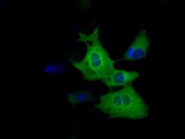 ZFP36 / Tristetraprolin Antibody (clone OTI3D10)