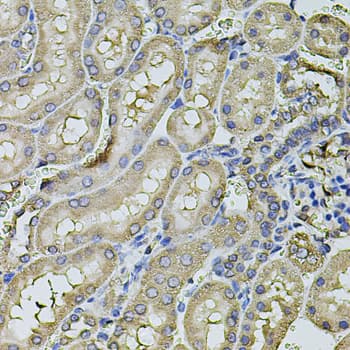 FDX1 / ADX Antibody