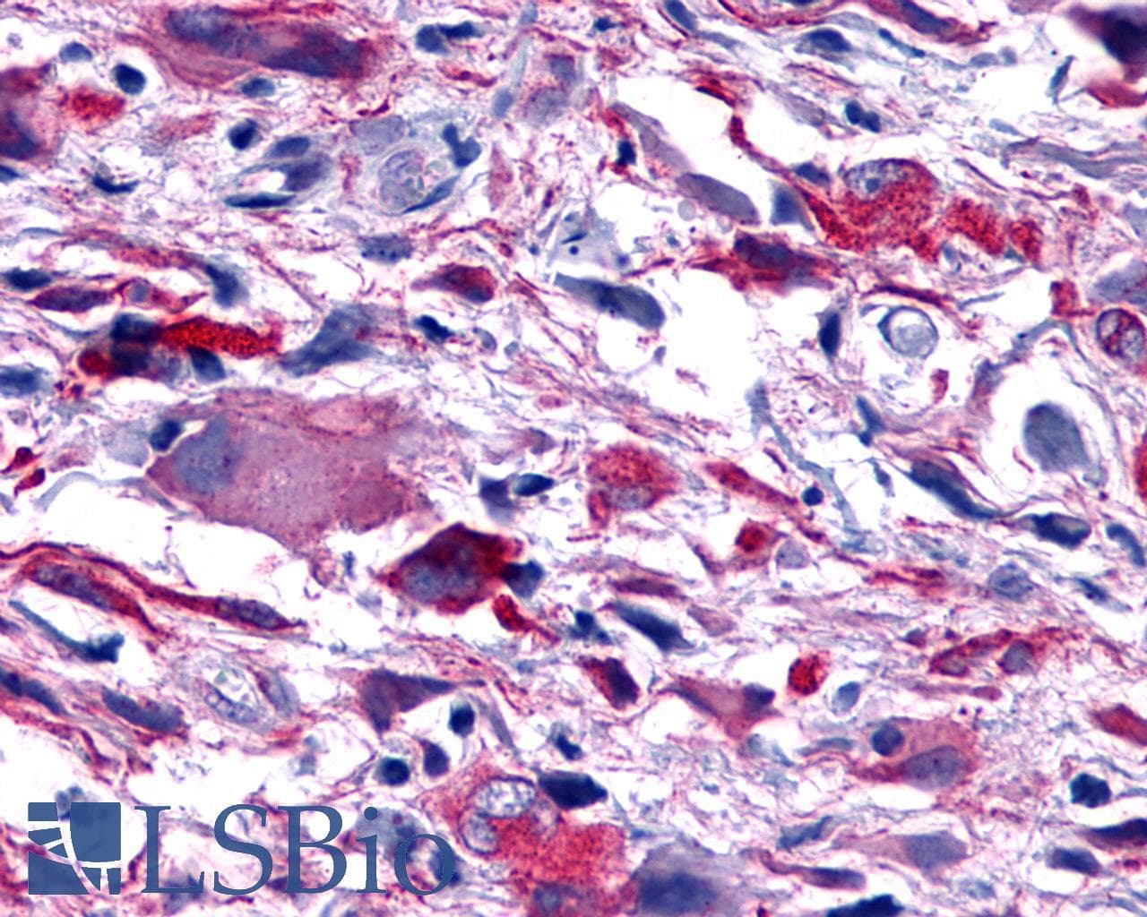PathPlus™ Polyclonal Rabbit anti-Human PTGER4 / EP4 Antibody (C-Terminus, IHC)