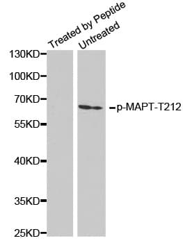 Polyclonal Rabbit anti-Human MAPT / Tau Antibody (phospho-Thr212, WB)