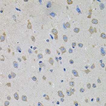 Polyclonal Rabbit anti-Human CCK4 / PTK7 Antibody (IHC, WB)