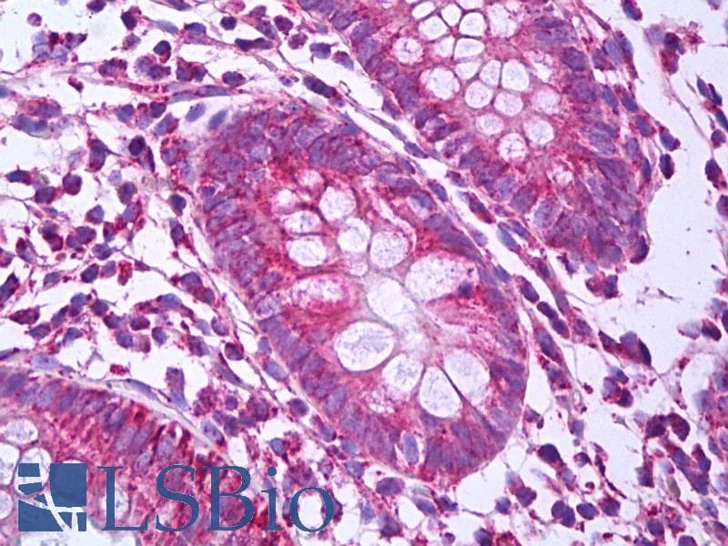 IHC-plus™ PHB / Prohibitin Antibody