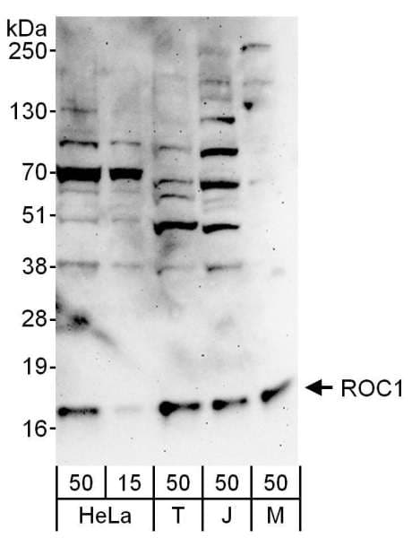 IHC-plus™ RBX1 / ROC1 Antibody (aa1-50)