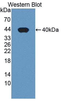 PDE1A Antibody (aa2-318)