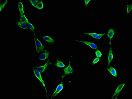 FBXL22 Antibody