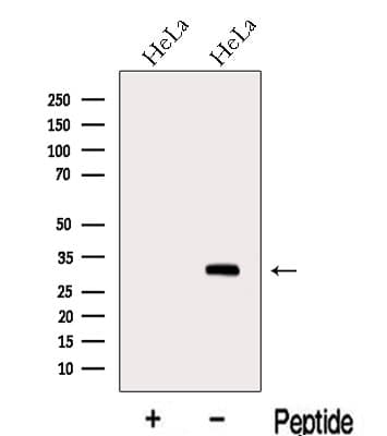 METTL6 Antibody