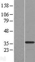 OSER1 / C20orf111 Protein (Over-Expression Lysate Myc-DDK (Flag))