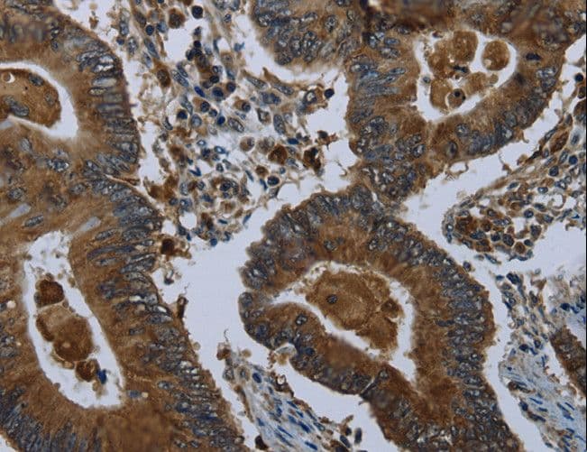 GLUL / Glutamine Synthetase Antibody