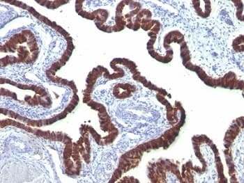 KRT7 / CK7 / Cytokeratin 7 Antibody (clone OV-TL12/30)