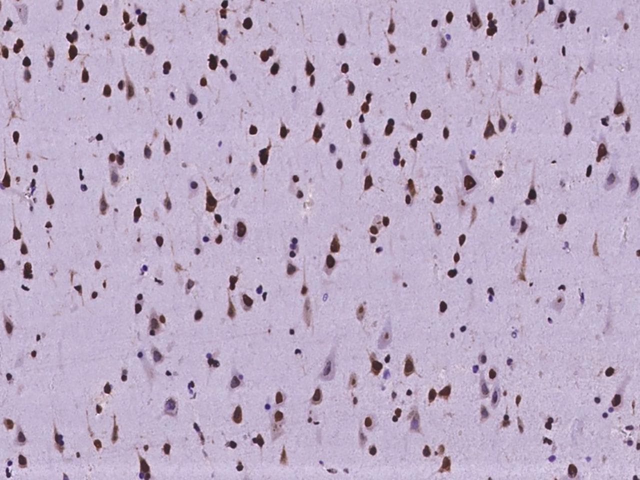 ZNF280A Antibody