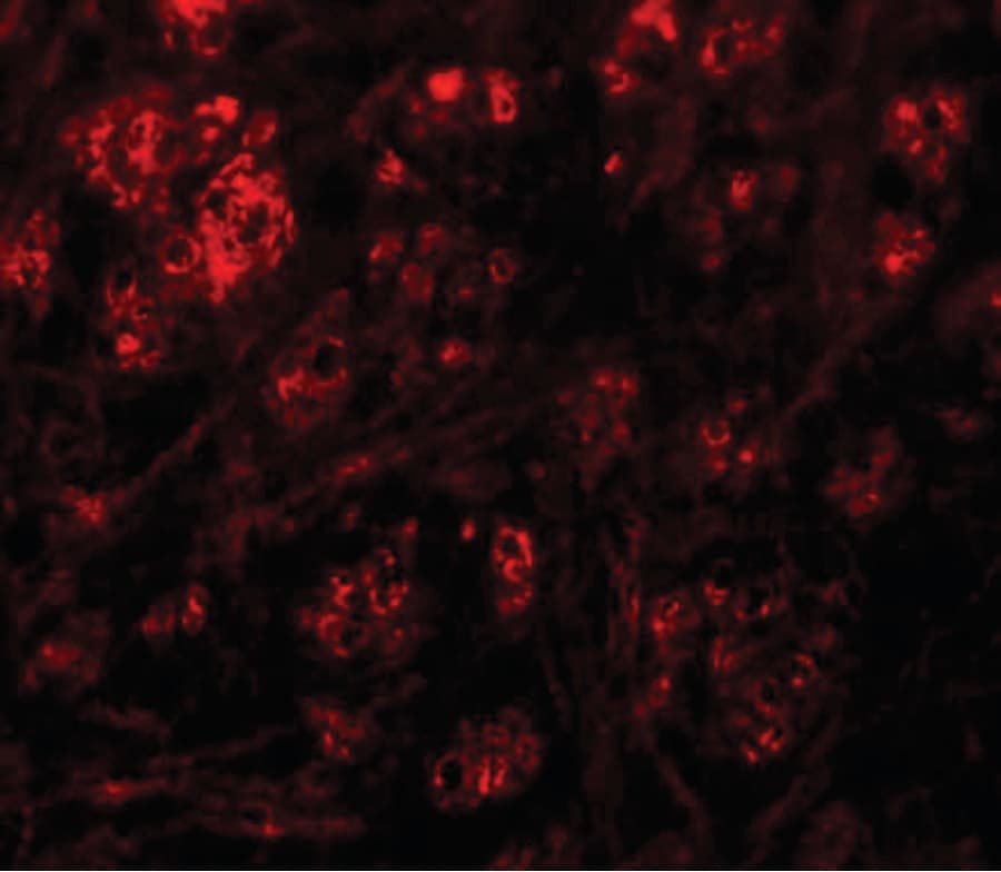 RABGEF1 Antibody