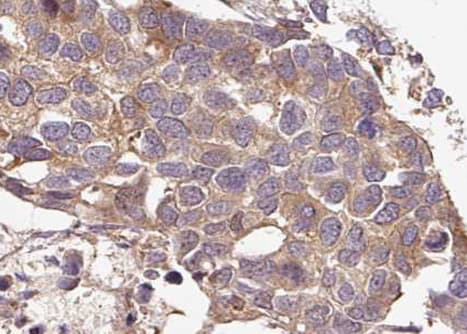 G3BP1 / G3BP Antibody (phospho-Ser232)