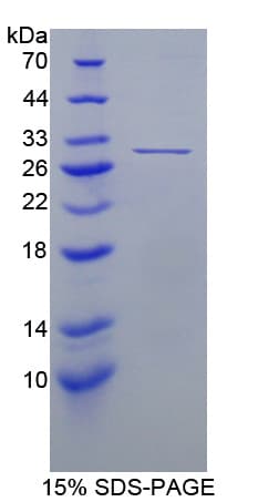 Mouse Uchl4 Protein (Recombinant His-T7)