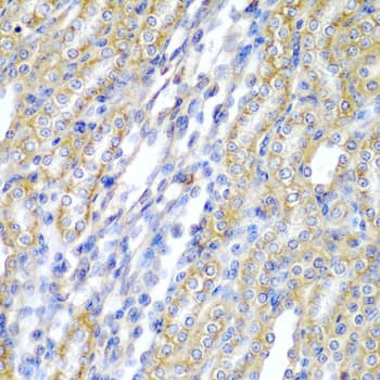CYP-M / CYP20A1 Antibody