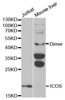 IHC-plus™ ICOS / CD278 Antibody