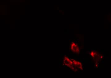 Polyclonal Rabbit anti-Human DGKB / DGK Beta Antibody (IF, WB)