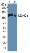 CD118 / LIF Receptor Alpha Antibody (aa381-485)