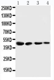 CTH / Cystathionase Antibody (aa316-331)