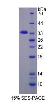 Mouse KERA / Keratocan Protein (Recombinant His-S)