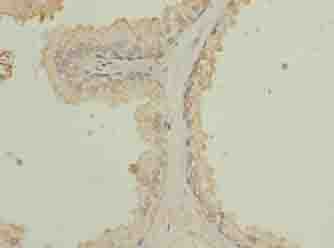 Polyclonal Rabbit anti-Human ZCCHC13 Antibody (IHC)