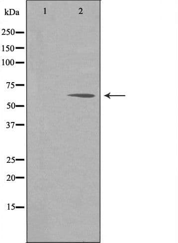 Polyclonal Rabbit anti-Human NPAS1 Antibody (IF, WB)