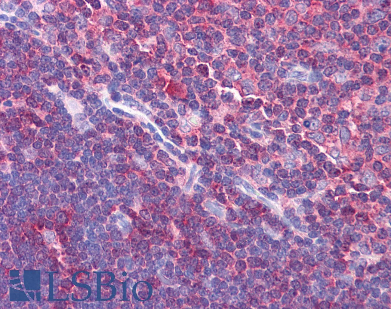 IHC-plus™ Polyclonal Rabbit anti-Human NOD8 / NLRP10 Antibody (IHC, IF, WB)