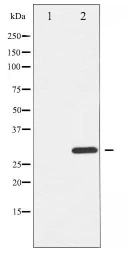 BIK Antibody (phospho-Thr33)