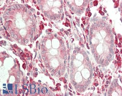 ERGIC3 Antibody (FITC)