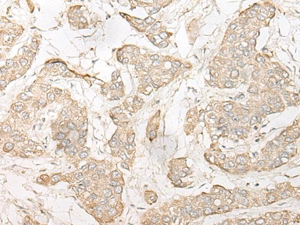 DHRS7 Antibody