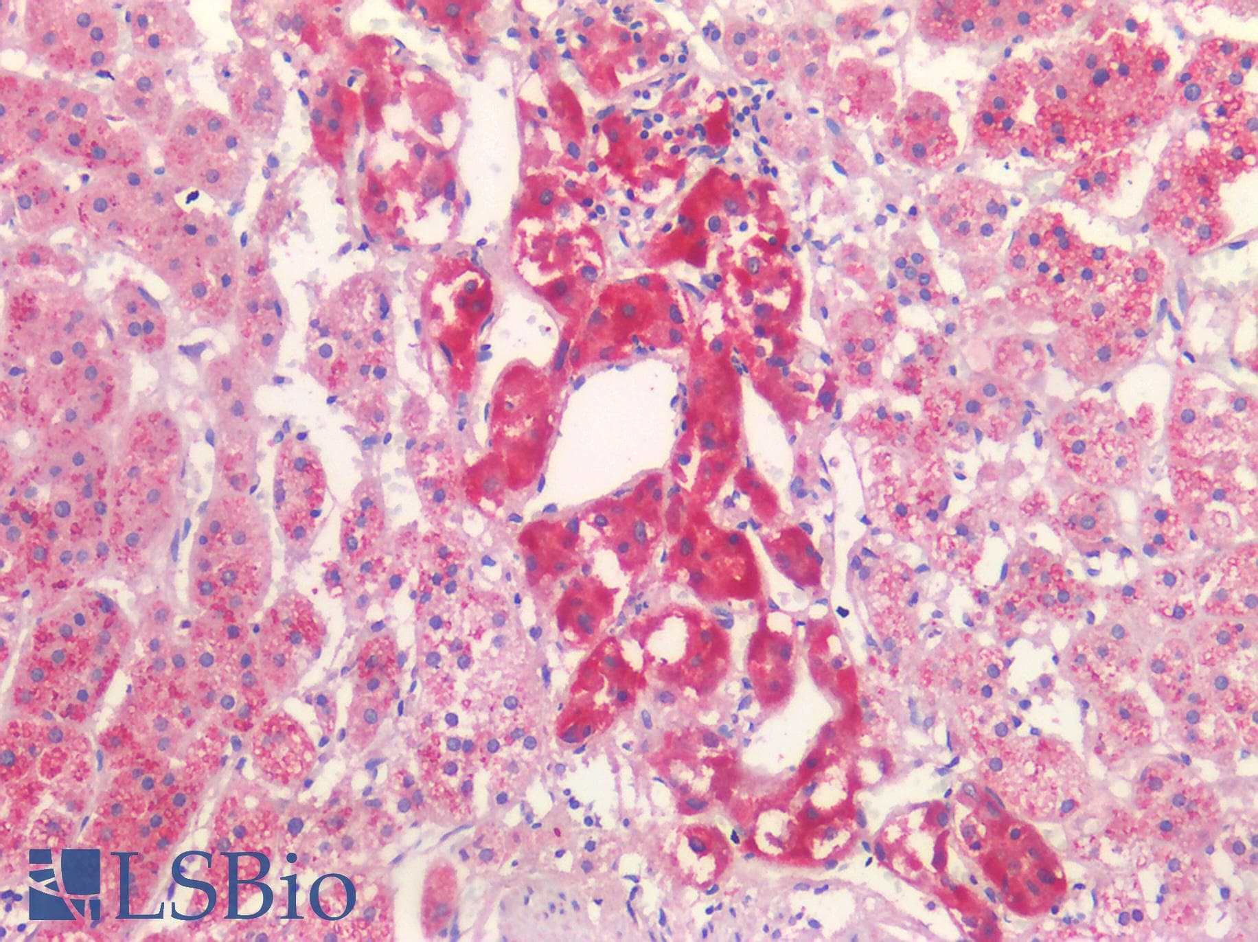 IHC-plus™ Polyclonal Rabbit anti-Human P2RX3 / P2X3 Antibody (IHC)