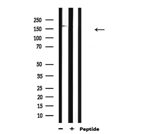 Polyclonal Rabbit anti-Human MYLK Antibody (WB)