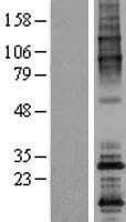 Human OPPO1 / ODF4 Protein (Over-Expression Lysate Myc-DDK (Flag))