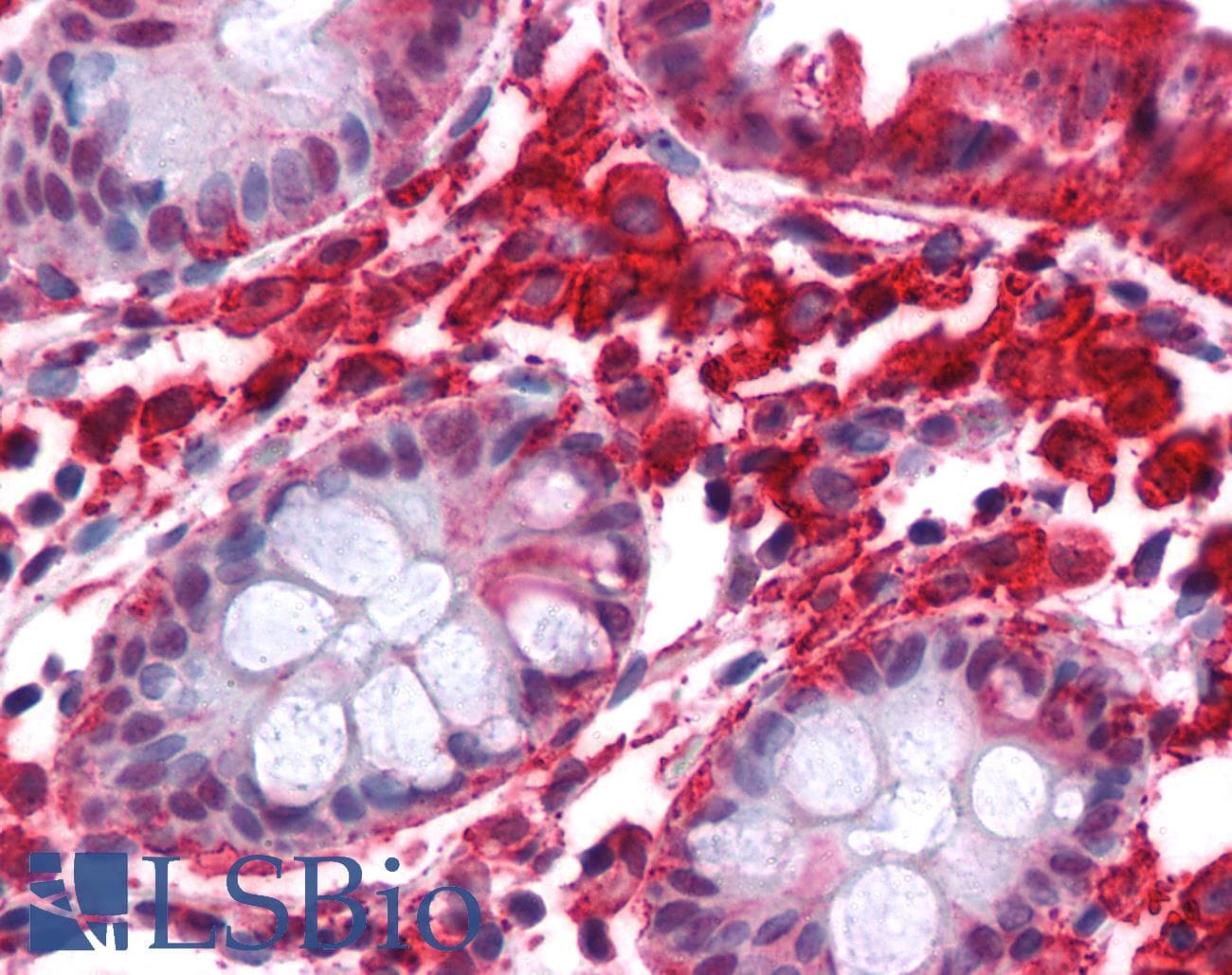 PathPlus™ STMN1 / Stathmin / LAG Antibody