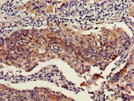 RBBP6 Antibody (aa51-97)