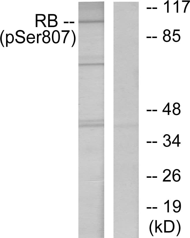 RB1 / Retinoblastoma / RB Antibody (phospho-Ser807)