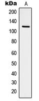 FAK / Focal Adhesion Kinase Antibody (phospho-Tyr925)