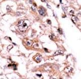 Polyclonal Rabbit anti-Human PPP3CC / CALNA3 Antibody (aa482-512, IHC, WB)