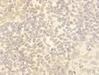 Cullin 4B / CUL4B Antibody (aa895-913)