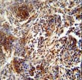 ZNF30 Antibody (aa1-30)