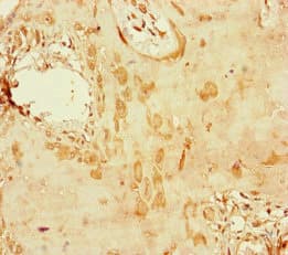 Polyclonal Rabbit anti-Human CENPU / MLF1IP Antibody (IHC, IF)