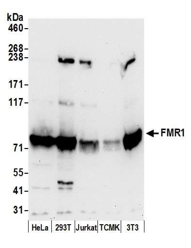 FMR1 / FMRP Antibody (aa600-650)