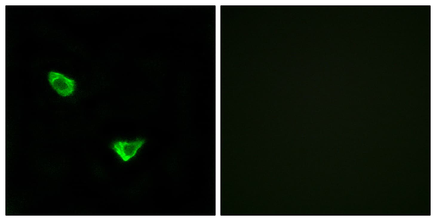IHC-plus™ Polyclonal Rabbit anti-Human CHPF / CHSY2 Antibody (aa631-680, IHC, IF, WB)