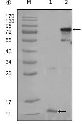 IHC-plus™ PPARG / PPAR Gamma Antibody (aa170-270, clone 3A4A9)