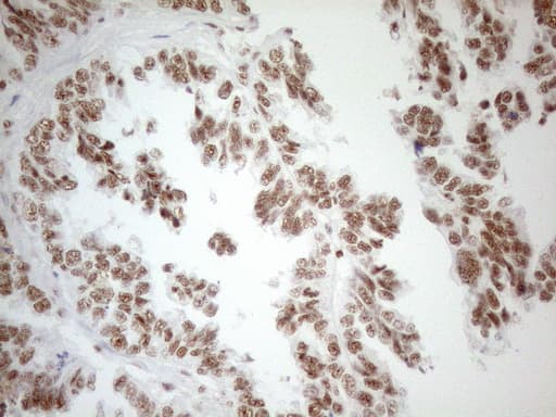 WTAP Antibody (aa2-106, clone OTI12G7, Carrier-free)