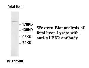 IHC-plus™ HAK / ALPK2 Antibody (C-Terminus)