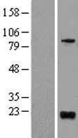 BTG1 Protein (Over-Expression Lysate Myc-DDK (Flag))